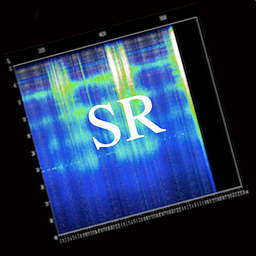 Schumann-Resonanz